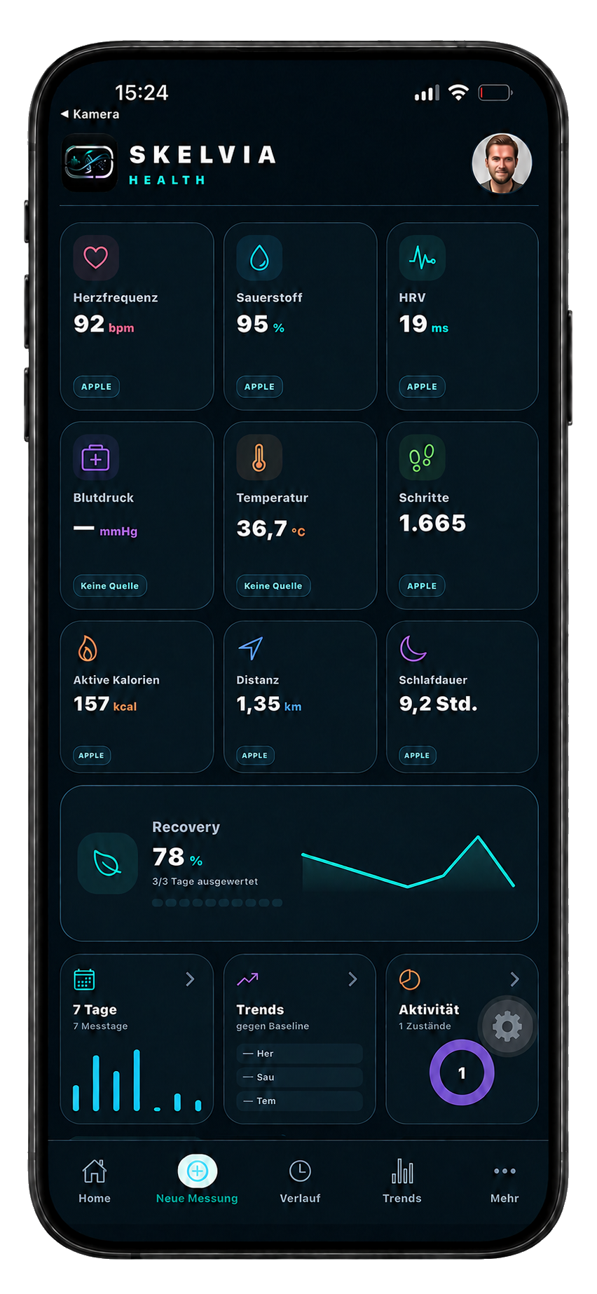 SKELVIA App: Messwerteansicht mit Herzfrequenz, SpO₂ und HRV