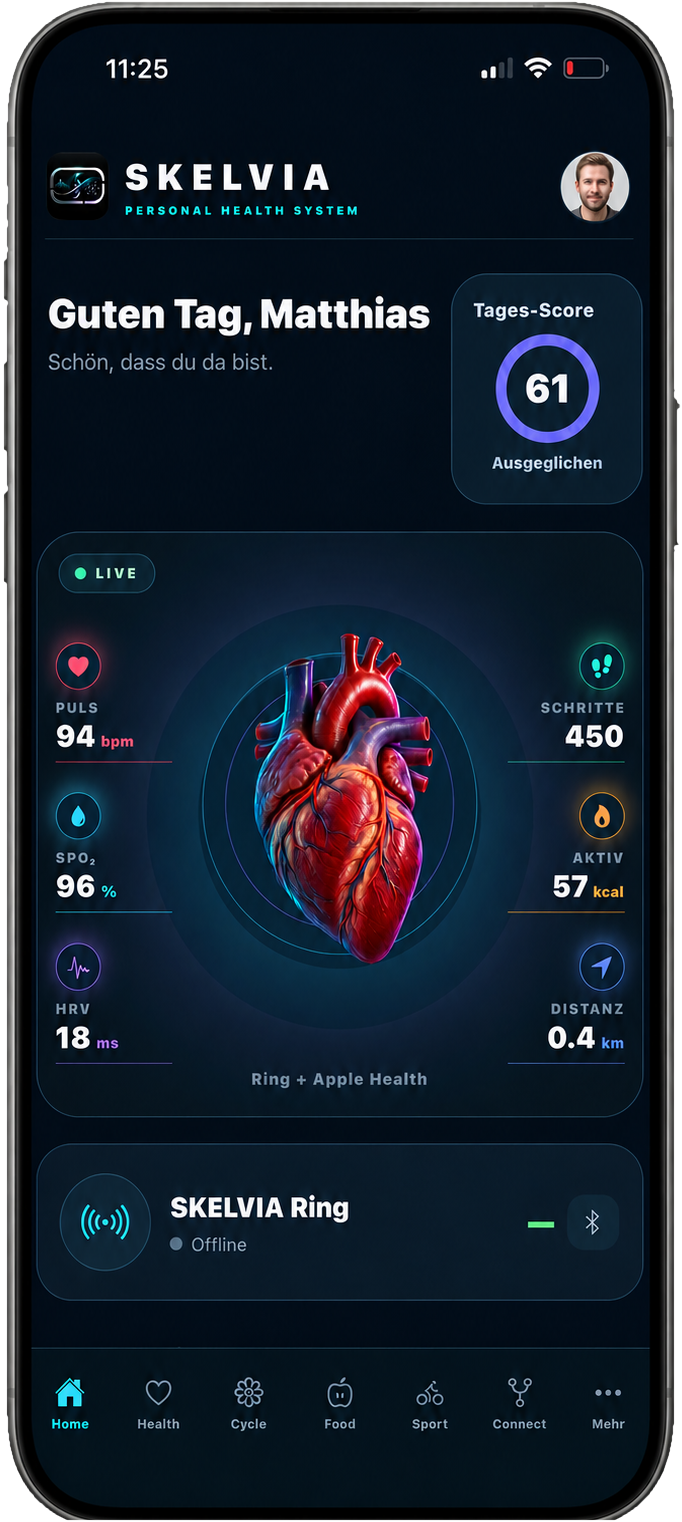 SKELVIA Health App – Startscreen mit Tages-Score, Puls, SpO₂, HRV, Schritten, Aktivität und Distanz